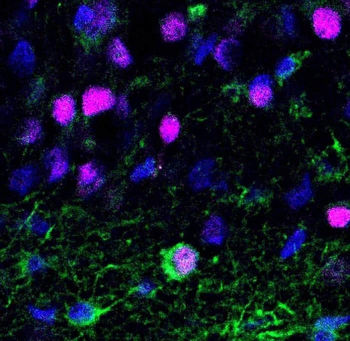 Newborn Neuron in Adult Brain Tissue.jpg