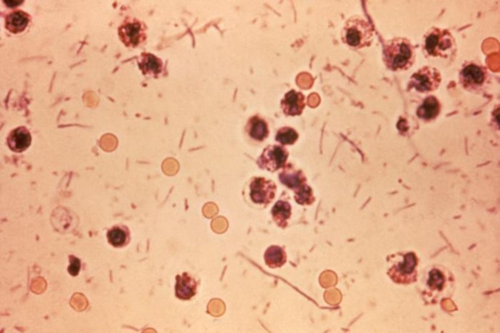 Shigella.jpg
