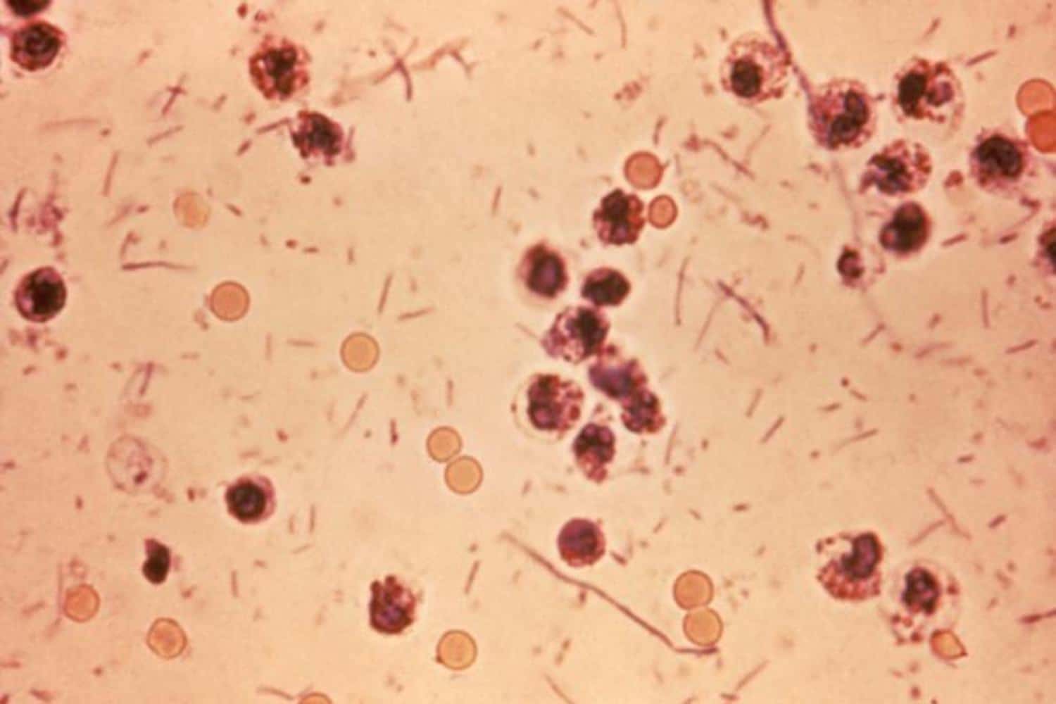 Shigella.jpg