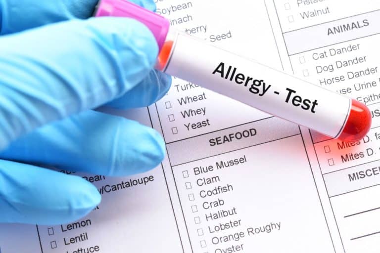 allergie alimentari test bambin gesu.jpg