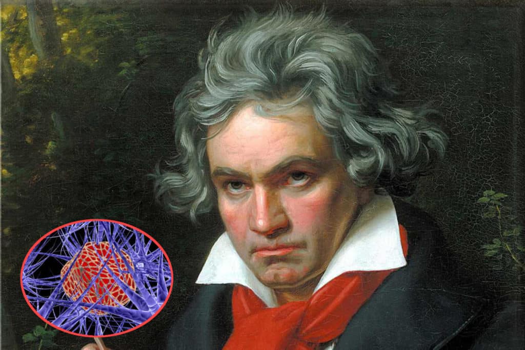Beethoven cancro.jpg