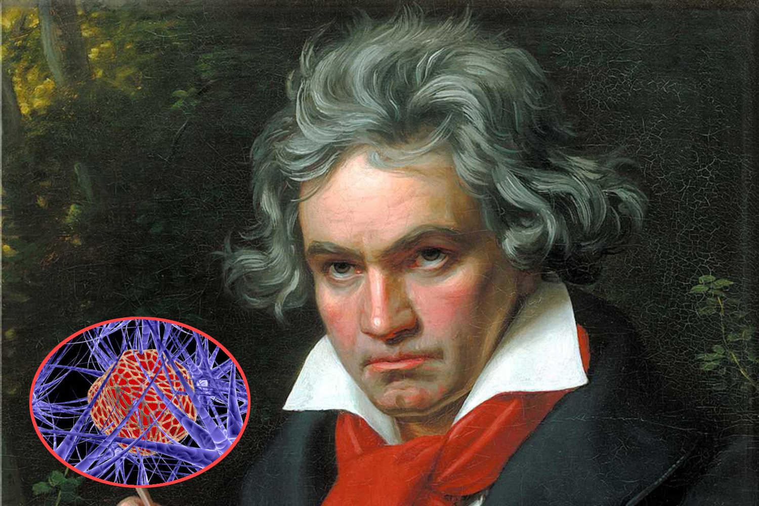 Beethoven cancro.jpg