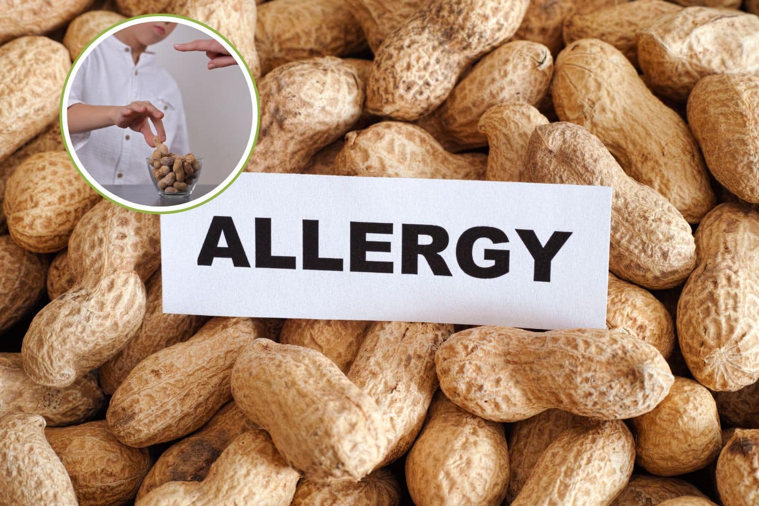 Allergia alle arachidi? Scoperto il trattamento che protegge gli adulti da reazioni mortali 1 allergia arachidi.jpg