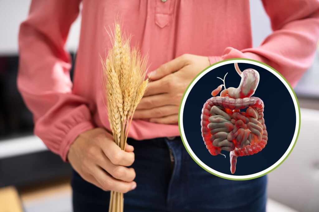 Scoprire di essere celiaci senza reintrodurre il glutine: il test che potrebbe rivoluzionare la diagnosi 2 celiachia farmaco