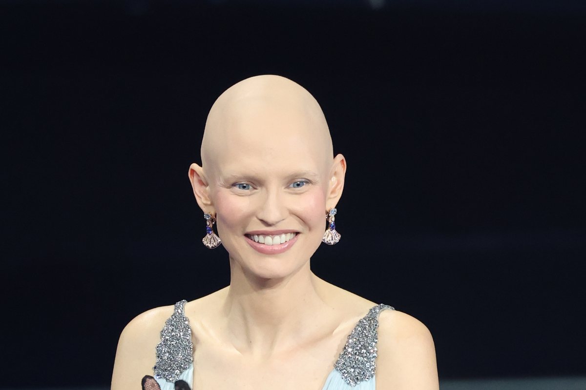Bianca Balti mostra la cicatrice 1 GI Bianca Balti.jpg