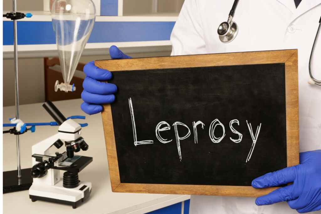 La lebbra è tornata in Europa dopo oltre 30 anni: come si trasmette e che rischi corriamo davvero 2 lebbra