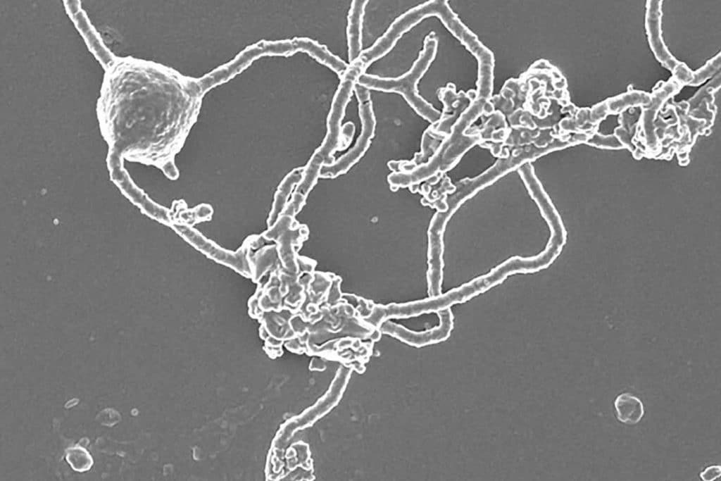 Asgard archaea.jpg