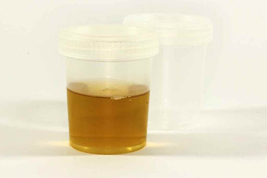 test urine