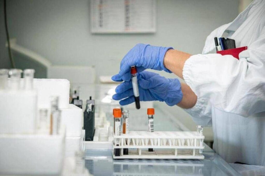 laboratorio analisi latina asl epatite A