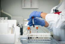 Latina – Esplode l’Epatite A: negli ultimi giorni 24 contagiati e 6 ricoverati, la ‘mappa’ della città colpite laboratorio analisi latina asl epatite A